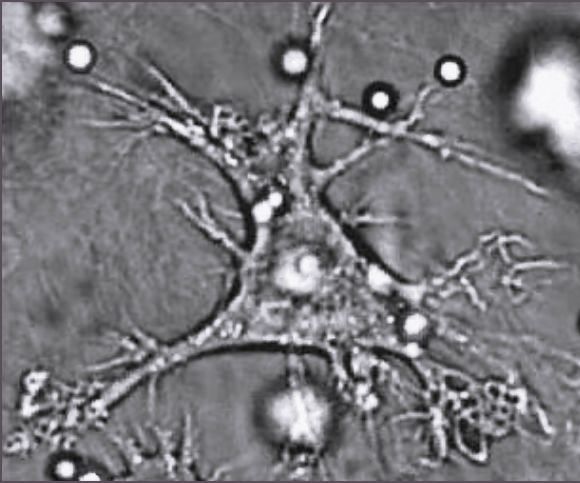 Células Dendríticas