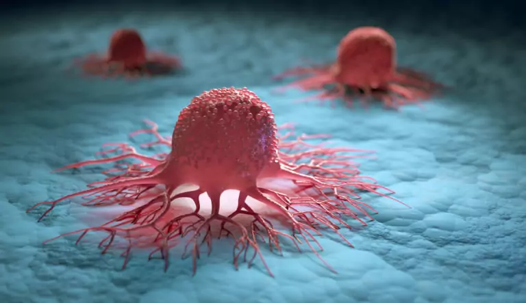 Cáncer e infecciones por el virus de Epstein-Barr