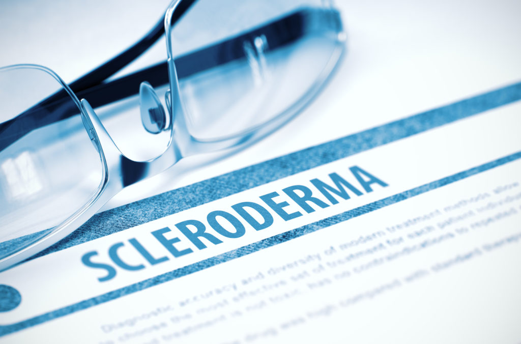 Esclerodermia y sistema inmune