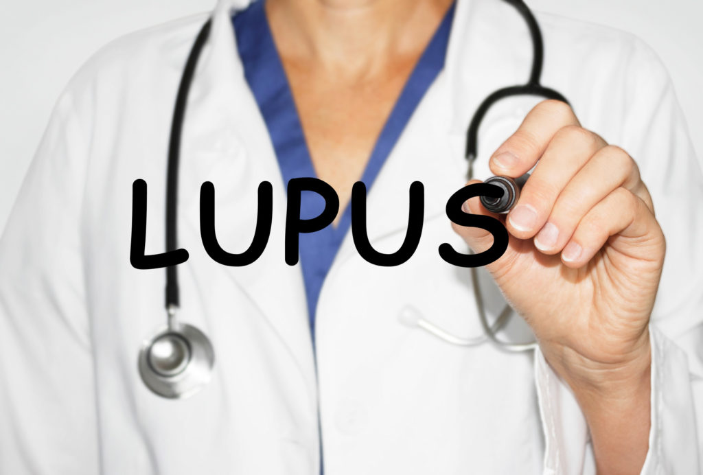 Lupus eritematosos sistémico e INF-1: Una relación potencialmente peligrosa