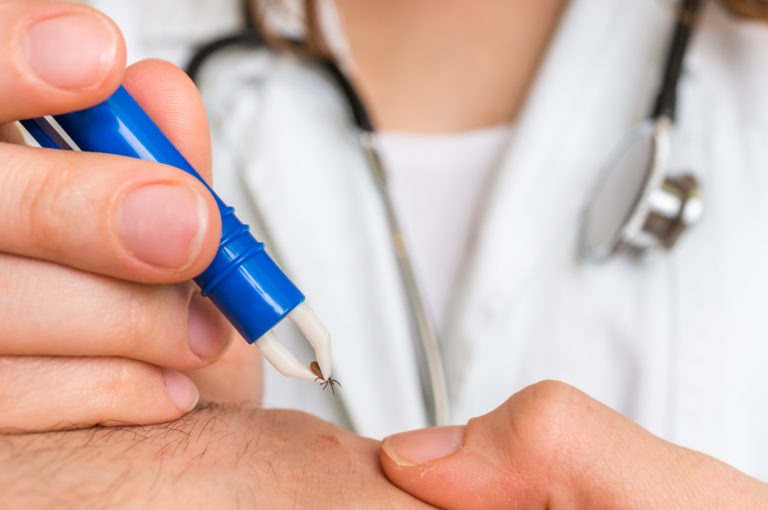 Female doctor removing a tick with tweezers from hand of patient. Encephalitis, borreliosis and lyme disease.