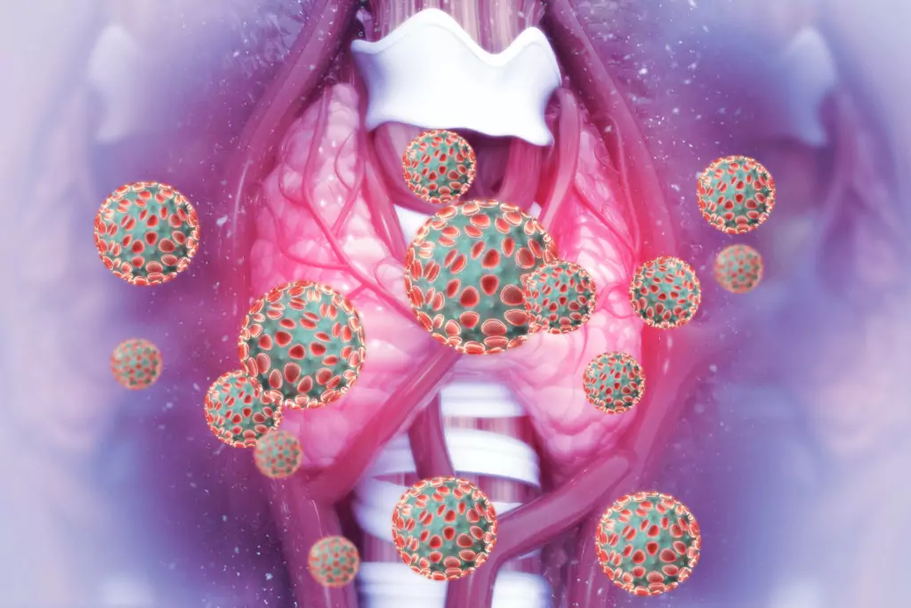 Tiroiditis de Quervain