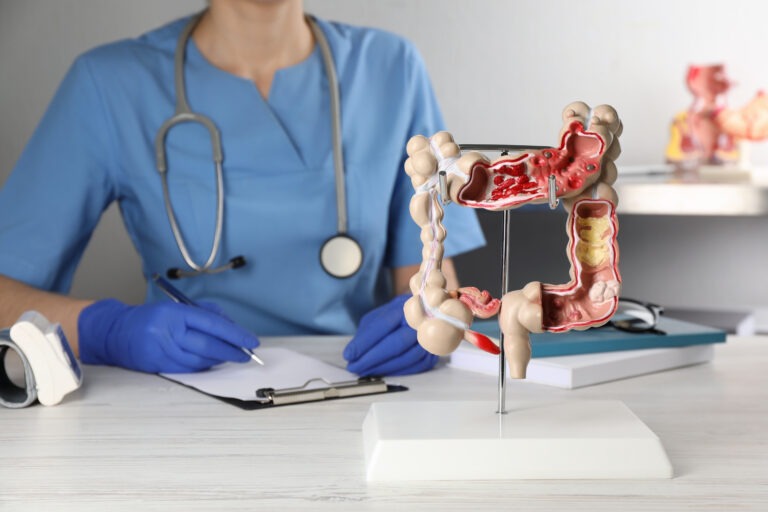 Cáncer de colon