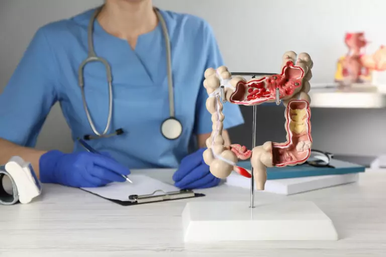 Cáncer de colon
